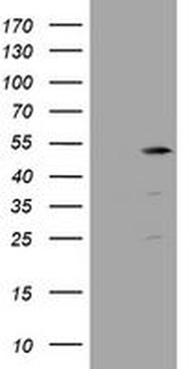 TBC1D13 Antibody in Western Blot (WB)