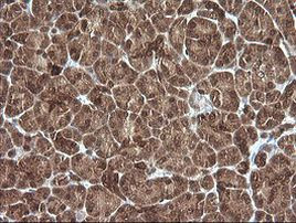 PIK3R5 Antibody in Immunohistochemistry (Paraffin) (IHC (P))