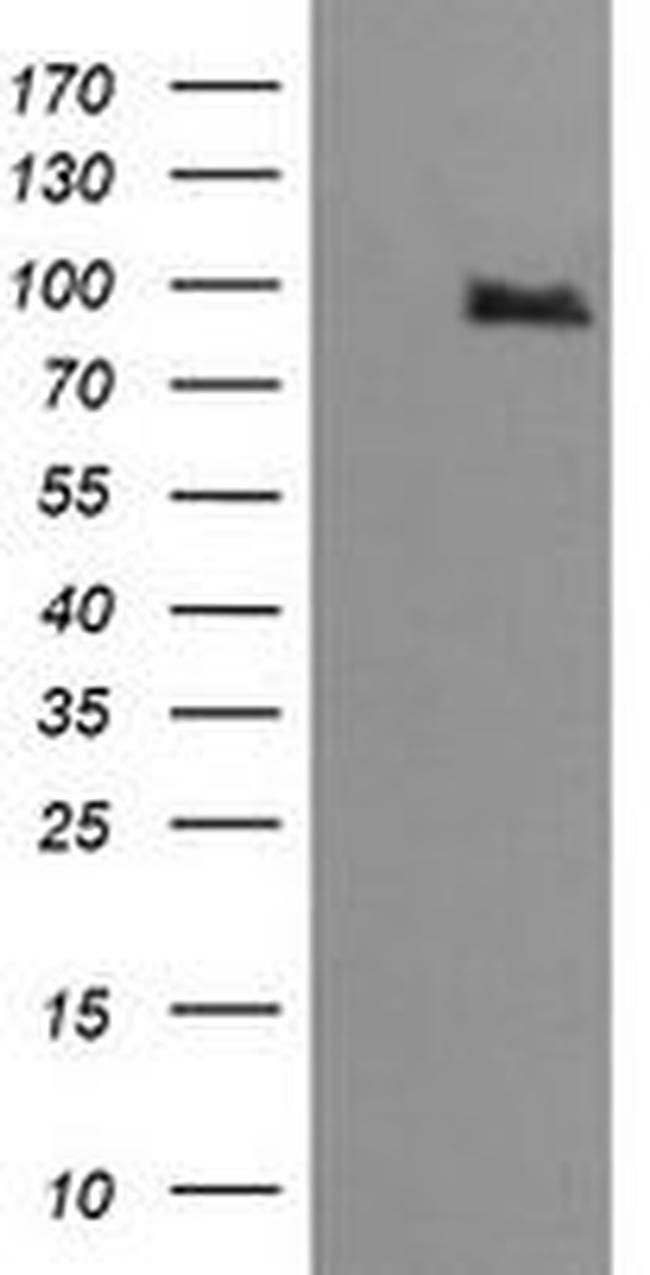 PIK3R5 Antibody in Western Blot (WB)