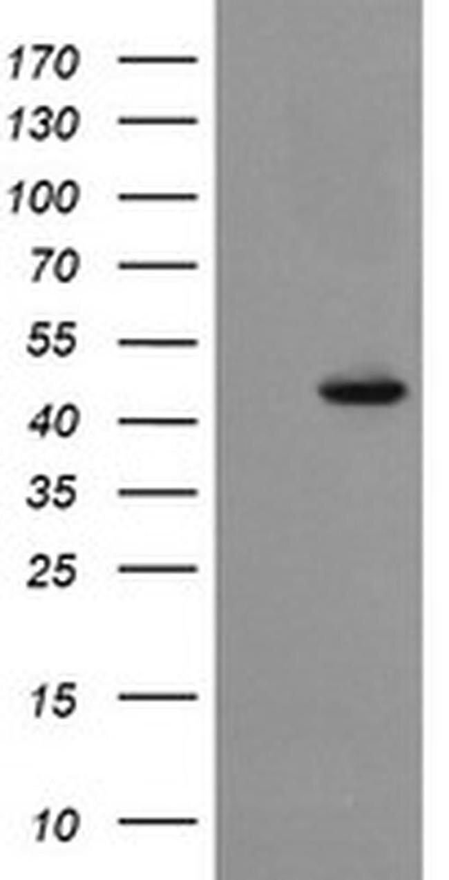 Synaptotagmin 4 Antibody in Western Blot (WB)