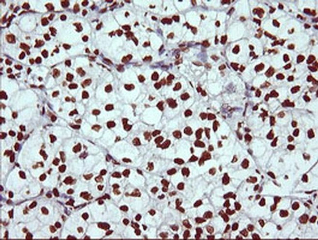 THUMPD1 Antibody in Immunohistochemistry (Paraffin) (IHC (P))