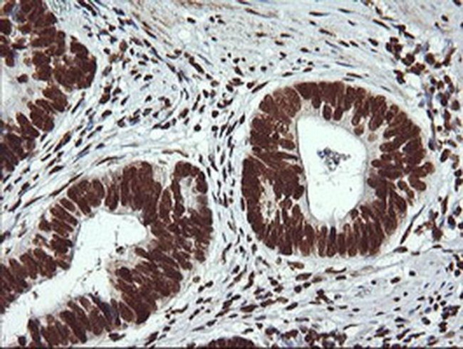 THUMPD1 Antibody in Immunohistochemistry (Paraffin) (IHC (P))