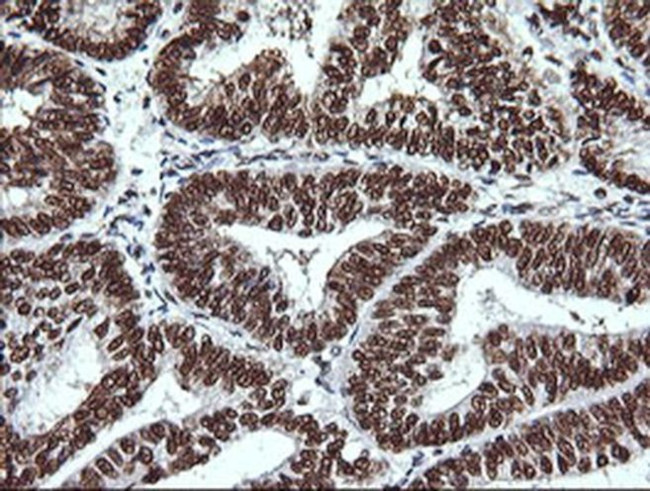 THUMPD1 Antibody in Immunohistochemistry (Paraffin) (IHC (P))