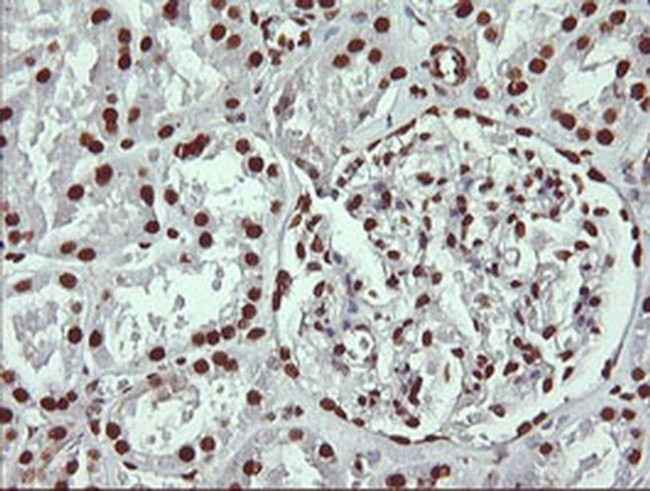 THUMPD1 Antibody in Immunohistochemistry (Paraffin) (IHC (P))