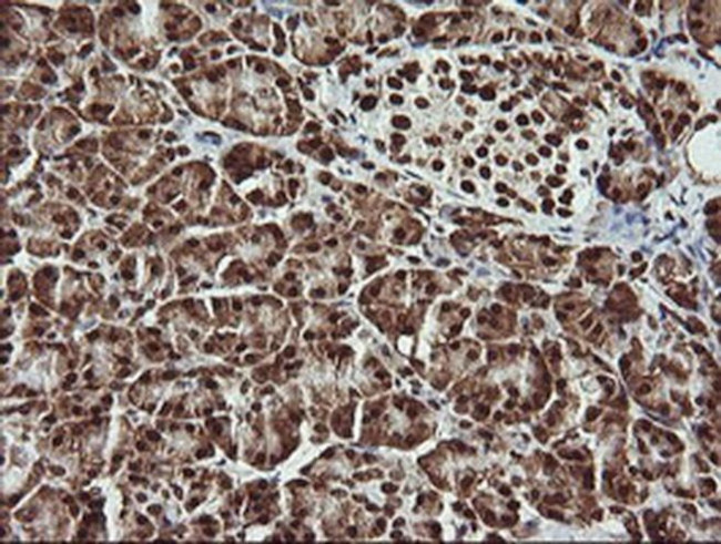 THUMPD1 Antibody in Immunohistochemistry (Paraffin) (IHC (P))