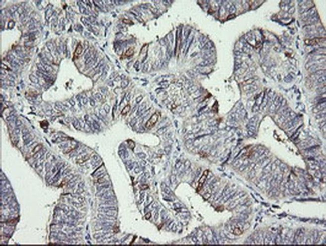 DPCD Antibody in Immunohistochemistry (Paraffin) (IHC (P))