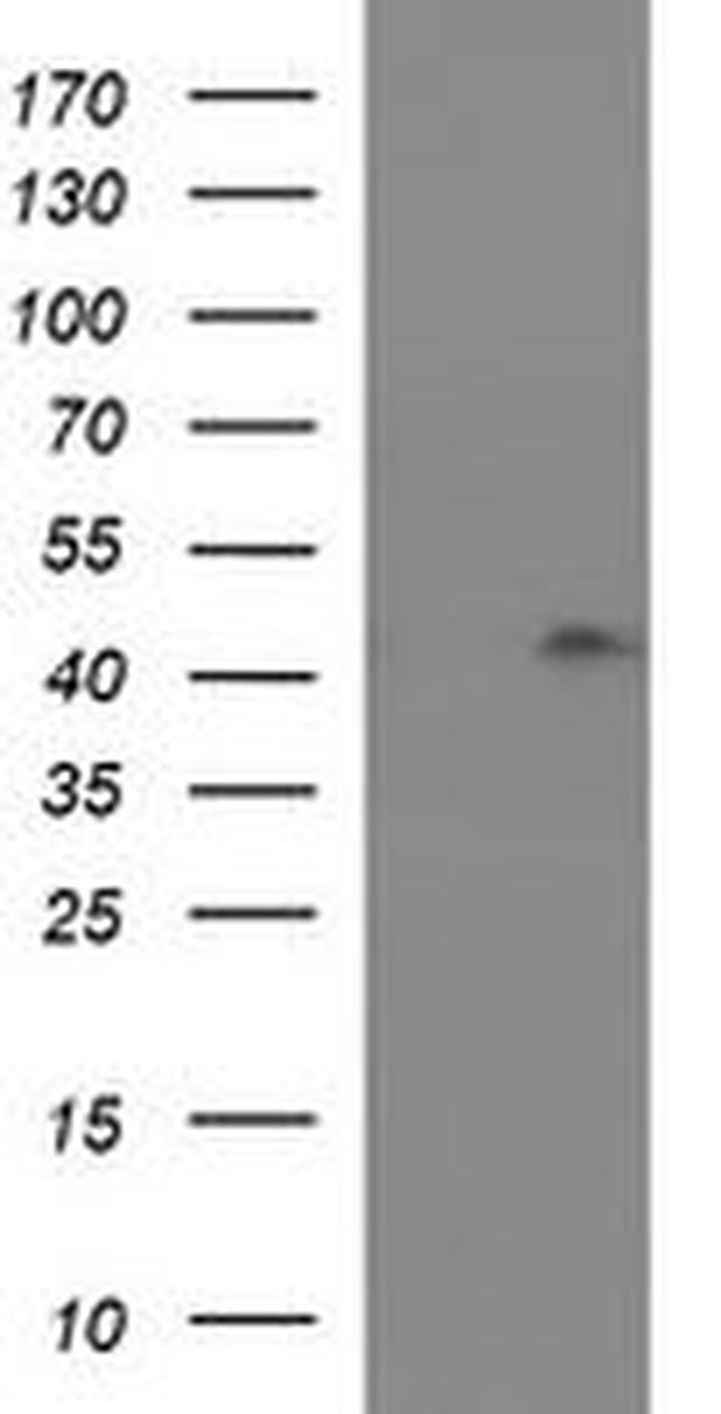 RASSF8 Antibody in Western Blot (WB)