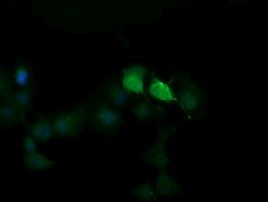 SESTD1 Antibody in Immunocytochemistry (ICC/IF)