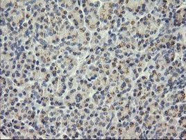 SESTD1 Antibody in Immunohistochemistry (Paraffin) (IHC (P))