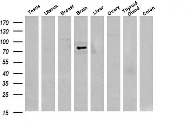 SESTD1 Antibody in Western Blot (WB)