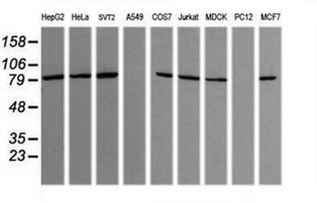 SESTD1 Antibody in Western Blot (WB)