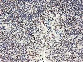 SESTD1 Antibody in Immunohistochemistry (Paraffin) (IHC (P))