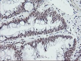 SESTD1 Antibody in Immunohistochemistry (Paraffin) (IHC (P))