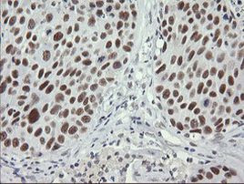 SESTD1 Antibody in Immunohistochemistry (Paraffin) (IHC (P))