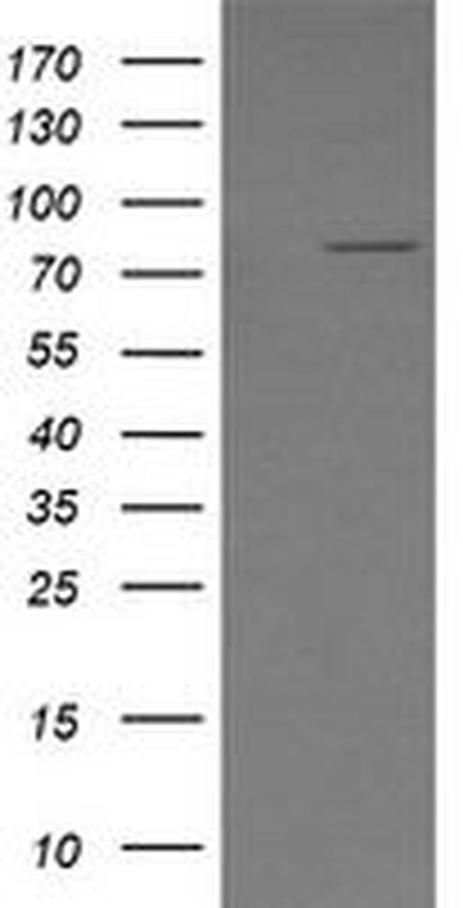 SESTD1 Antibody in Western Blot (WB)