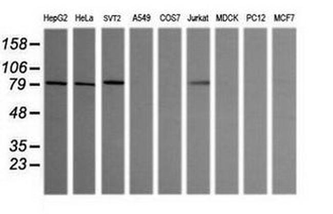 SESTD1 Antibody in Western Blot (WB)