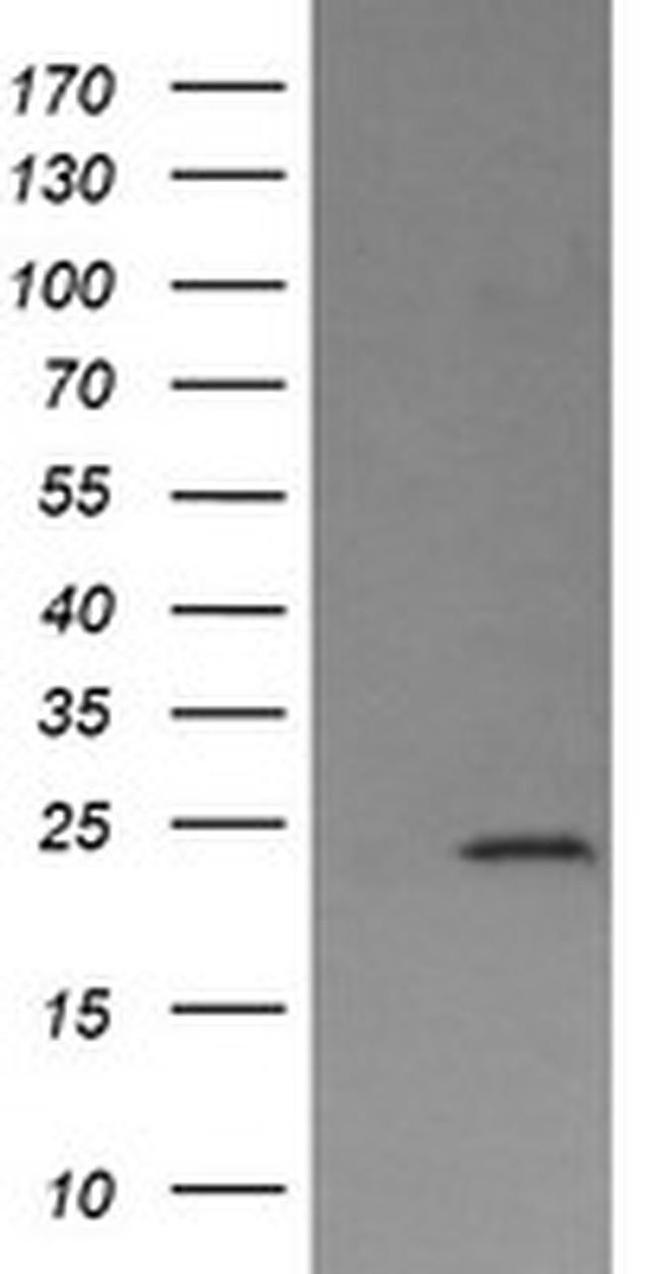 DPCD Antibody in Western Blot (WB)