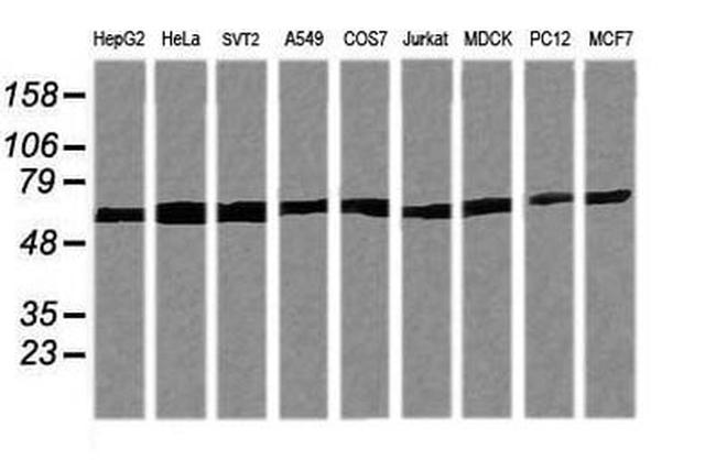 TRIM38 Antibody in Western Blot (WB)