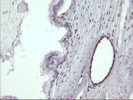 TRIM38 Antibody in Immunohistochemistry (Paraffin) (IHC (P))