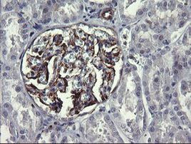 TRIM38 Antibody in Immunohistochemistry (Paraffin) (IHC (P))