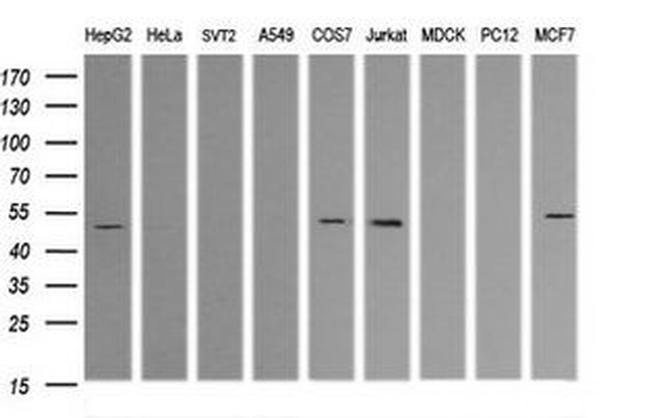 TRIM38 Antibody in Western Blot (WB)