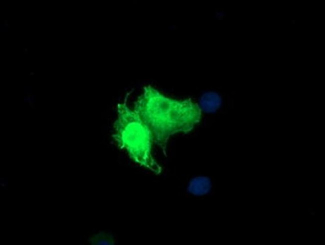 PARVA Antibody in Immunocytochemistry (ICC/IF)