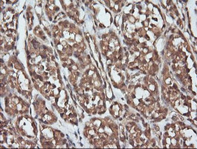 PARVA Antibody in Immunohistochemistry (Paraffin) (IHC (P))