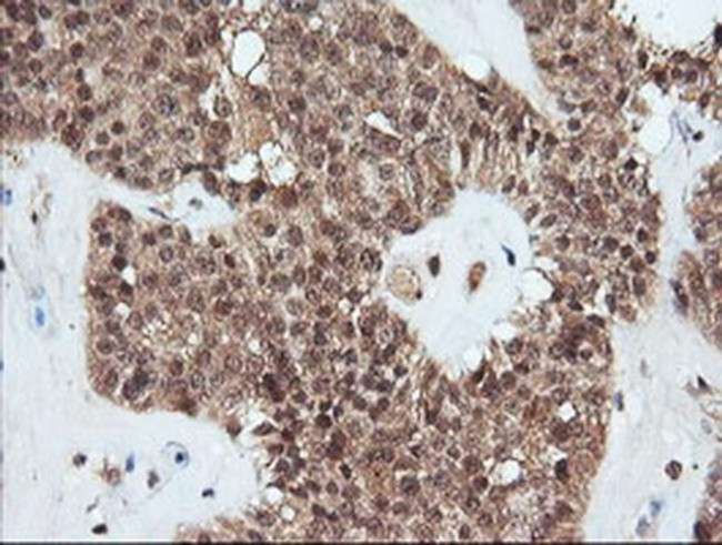 PARVA Antibody in Immunohistochemistry (Paraffin) (IHC (P))