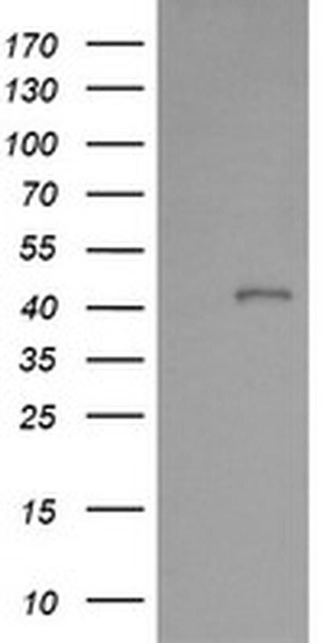 PARVA Antibody in Western Blot (WB)