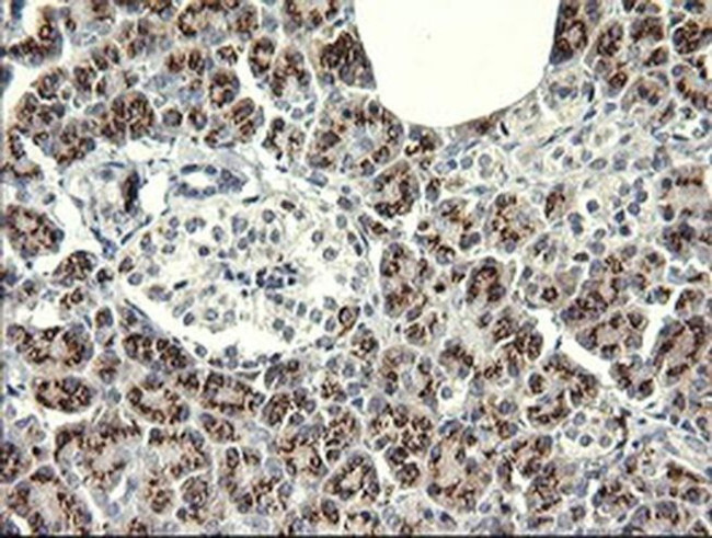 IL1F9 Antibody in Immunohistochemistry (Paraffin) (IHC (P))