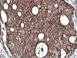 PIK3C2B Antibody in Immunohistochemistry (Paraffin) (IHC (P))