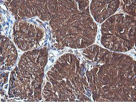 PIK3C2B Antibody in Immunohistochemistry (Paraffin) (IHC (P))