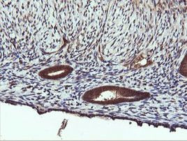 PIK3C2B Antibody in Immunohistochemistry (Paraffin) (IHC (P))