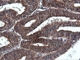 PIK3C2B Antibody in Immunohistochemistry (Paraffin) (IHC (P))