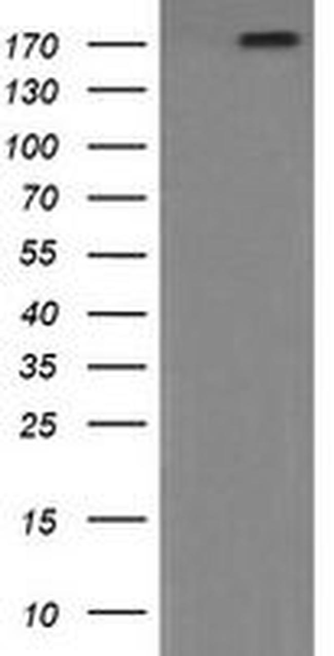 PIK3C2B Antibody in Western Blot (WB)