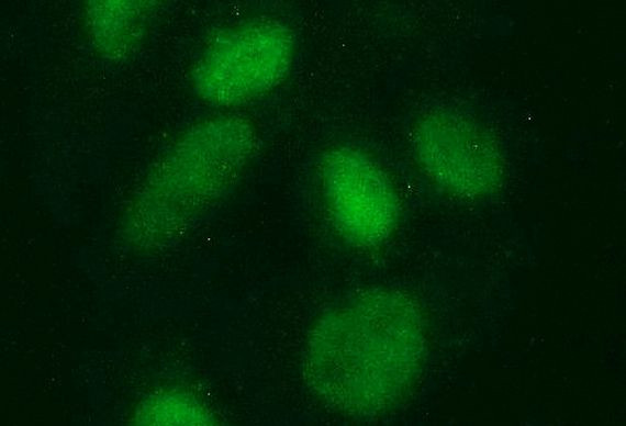 SAE1 Antibody in Immunocytochemistry (ICC/IF)