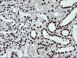 SAE1 Antibody in Immunohistochemistry (Paraffin) (IHC (P))