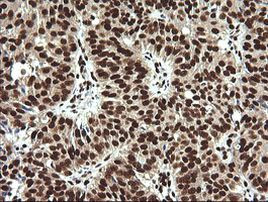 SAE1 Antibody in Immunohistochemistry (Paraffin) (IHC (P))