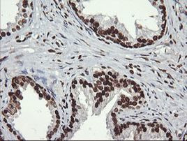 SAE1 Antibody in Immunohistochemistry (Paraffin) (IHC (P))