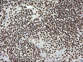 SAE1 Antibody in Immunohistochemistry (Paraffin) (IHC (P))