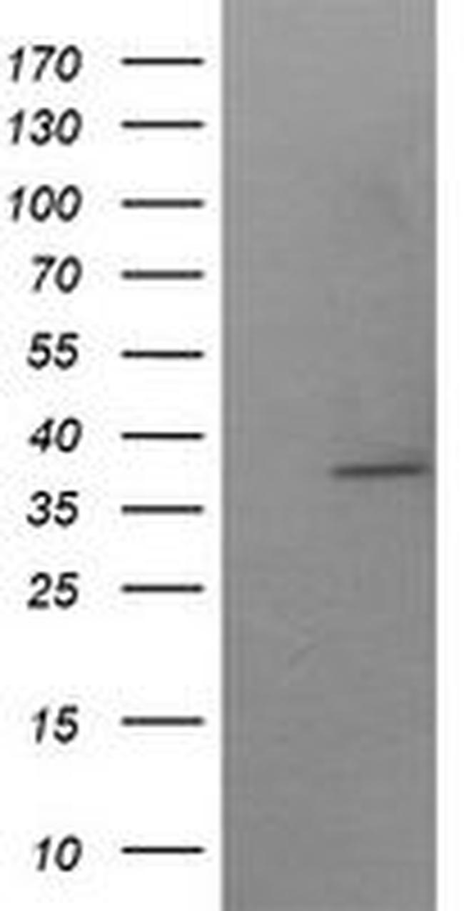 SAE1 Antibody in Western Blot (WB)