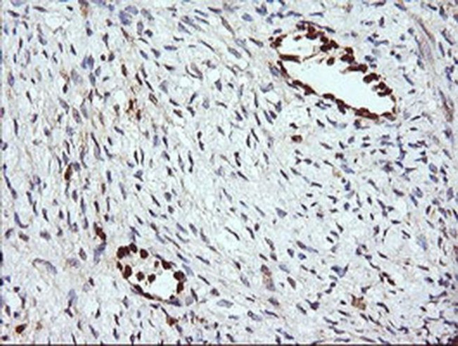 ERG Antibody in Immunohistochemistry (Paraffin) (IHC (P))