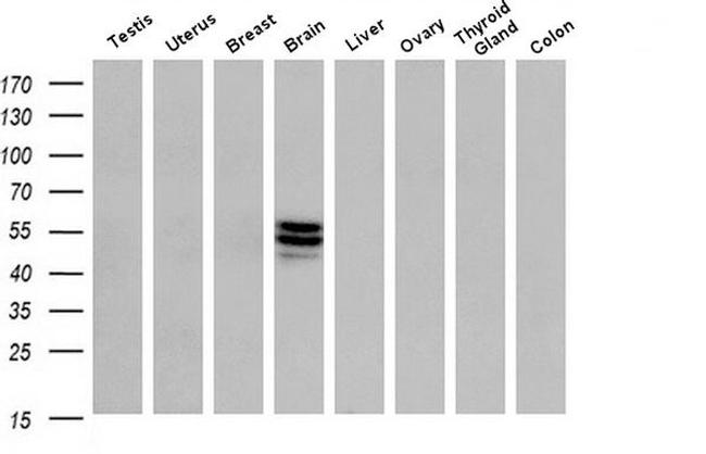 ERG Antibody in Western Blot (WB)