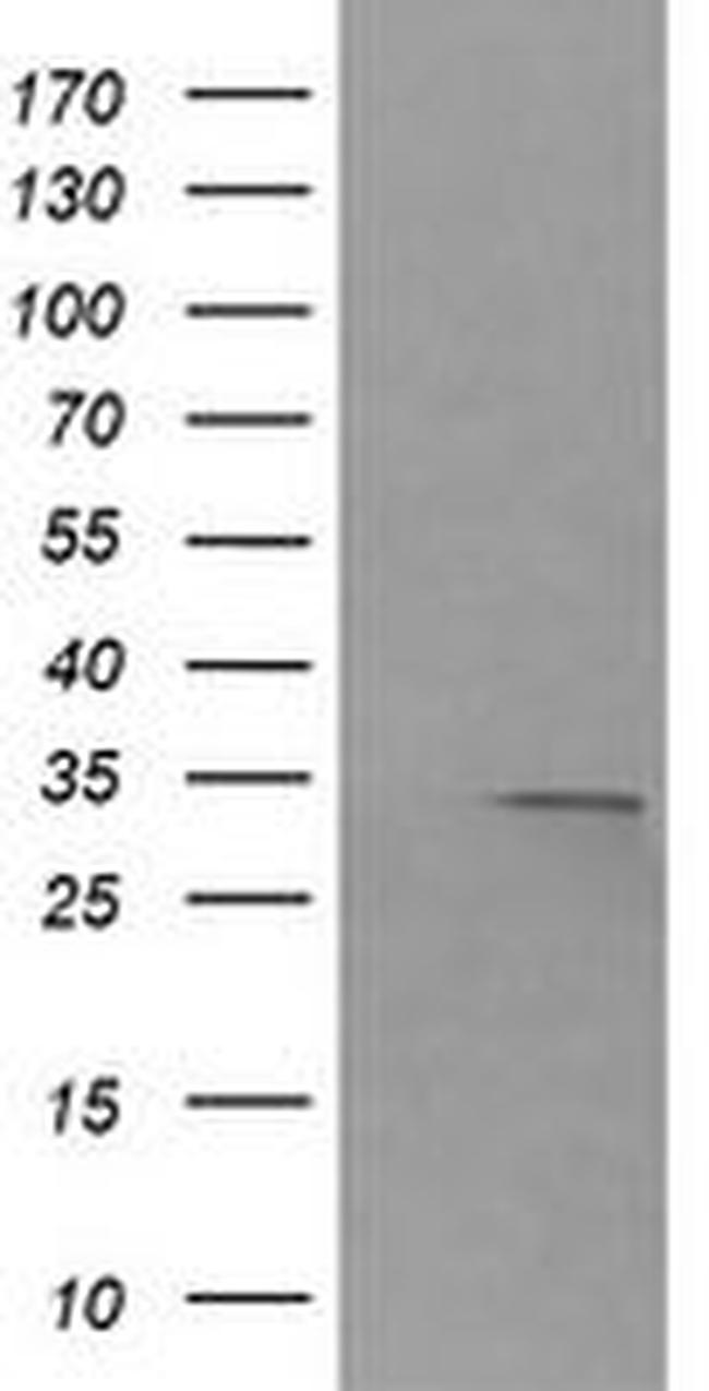 RARRES1 Antibody in Western Blot (WB)