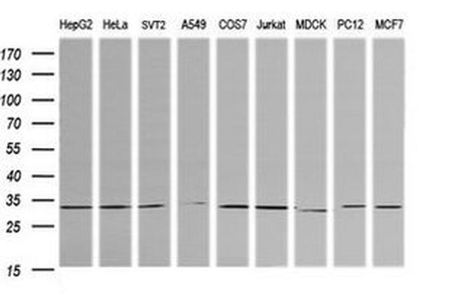 RARRES1 Antibody in Western Blot (WB)