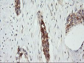 RARRES1 Antibody in Immunohistochemistry (Paraffin) (IHC (P))