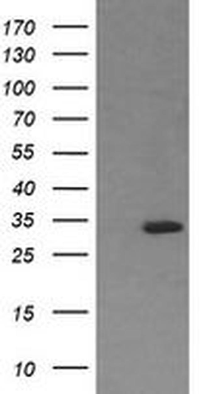 RARRES1 Antibody in Western Blot (WB)