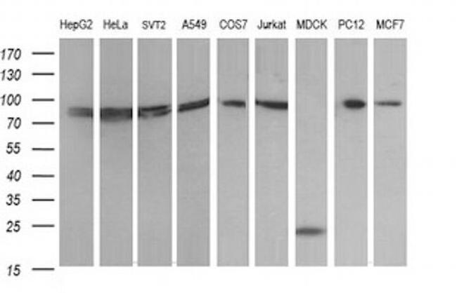 DNM1L Antibody in Western Blot (WB)