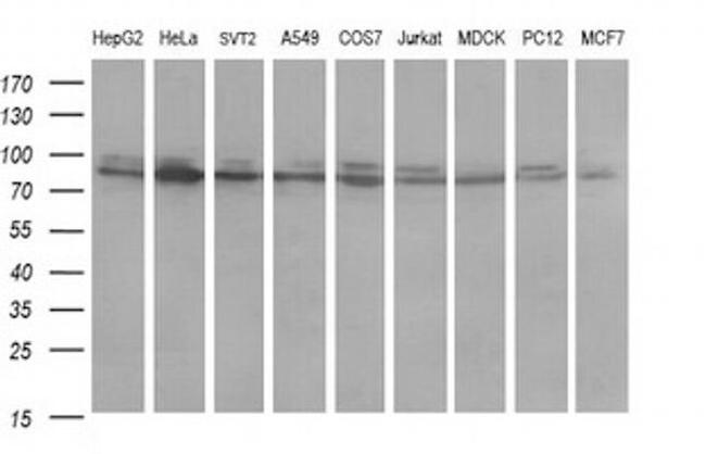 DNM1L Antibody in Western Blot (WB)