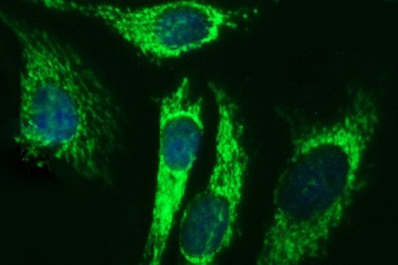 ACAA2 Antibody in Immunocytochemistry (ICC/IF)